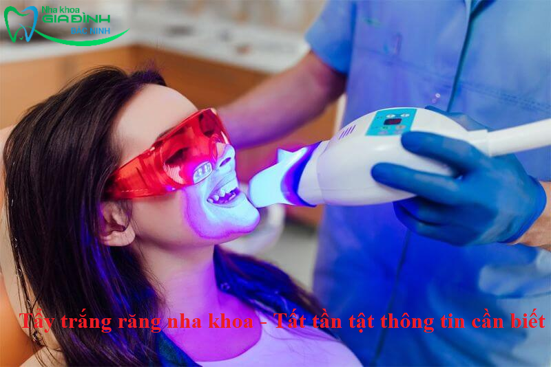 Tẩy trắng răng nha khoa - Tất tần tật thông tin cần biết 1 Tẩy trắng răng nha khoa - Tất tần tật thông tin cần biết