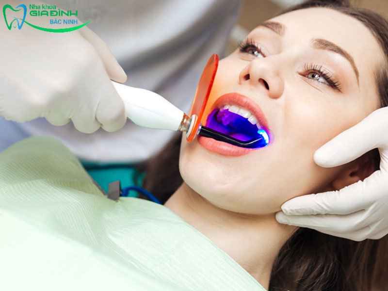 Tẩy trắng răng nha khoa - Tất tần tật thông tin cần biết 3 Sử dụng năng lượng ánh sáng xanh để làm trắng răng hiệu quả