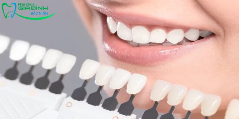 Tẩy trắng răng nha khoa - Tất tần tật thông tin cần biết 4 Phương pháp tẩy trắng răng nội nha cho khách hàng