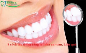 8 cách tẩy trắng răng tại nhà an toàn, hiệu quả