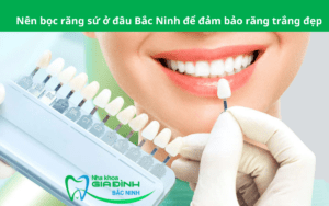 Nên bọc răng sứ ở đâu Bắc Ninh để đảm bảo răng trắng đẹp (1)