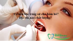 avt boc rang su cho ham ho