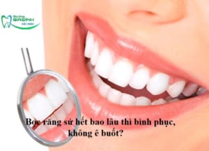 avt boc rang su het bao lau