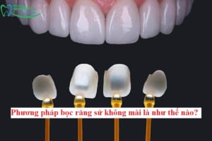 avt boc rang su khong mai