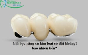 avt gia boc rang su kim loai