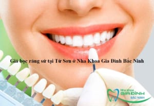 avt gia boc rang su tai tu son