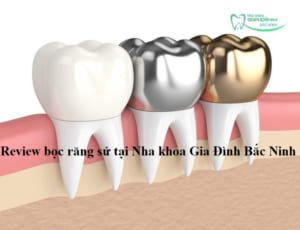 avt review boc rang su