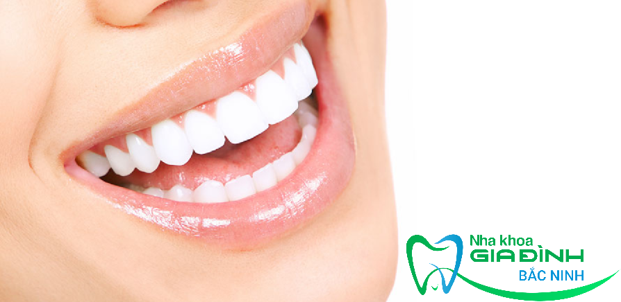 Có nên bọc răng sứ cho hàm hô? Địa chỉ nào chất lượng? 3 Nha khoa gia đình Bắc Ninh với đội ngũ bác sĩ có tâm huyết.