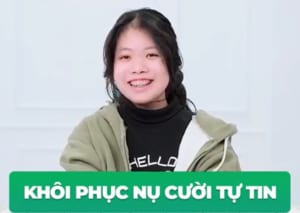 Tại sao cần phải niềng răng Những lợi ích của việc niềng răng chỉnh nha mà bạn nên biết