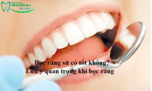 avt boc rang su co tot khong