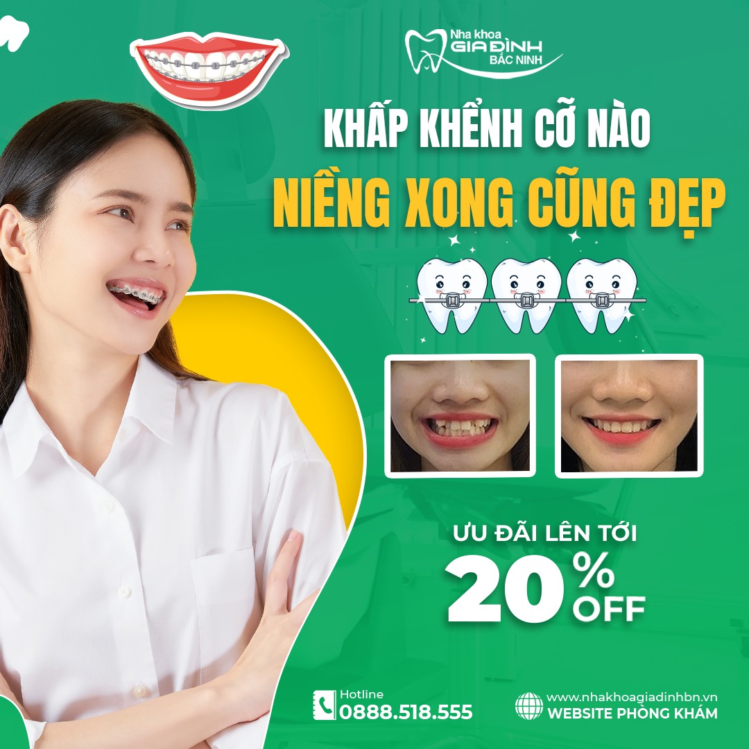 hình ảnh niềng răng tại Nha Khoa Gia Đình Bắc Ninh thuộc trong Top 3 địa chỉ niềng răng uy tín chuyên sâu tại Bắc Ninh