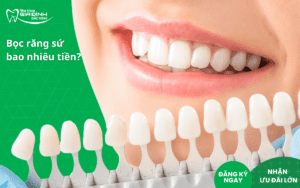 Bọc răng sứ bao nhiêu tiền? Bọc răng sứ ở đâu Bắc Ninh uy tín?