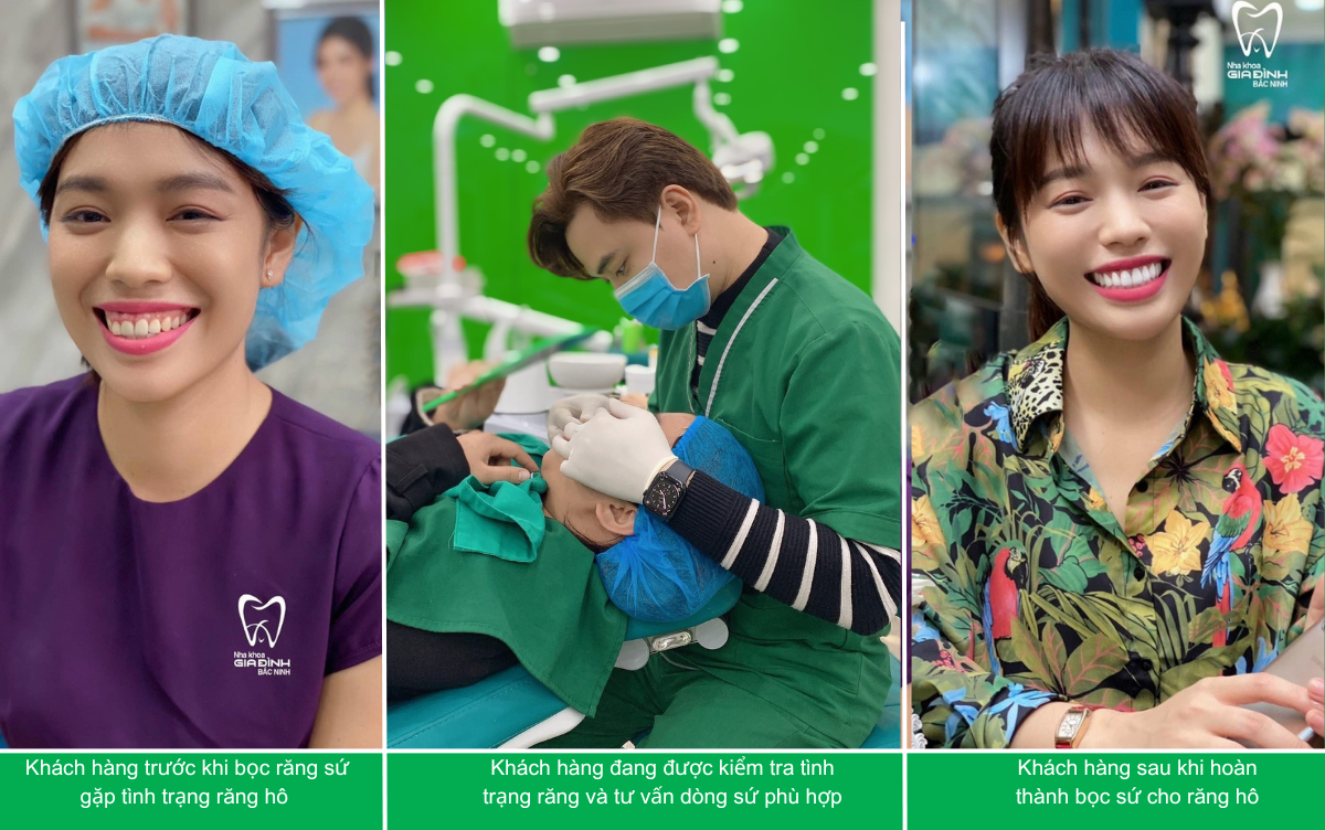 Răng Hô Có Bọc Sứ Được Không? 3 anh Boc su cho rang ho o dau uy tin