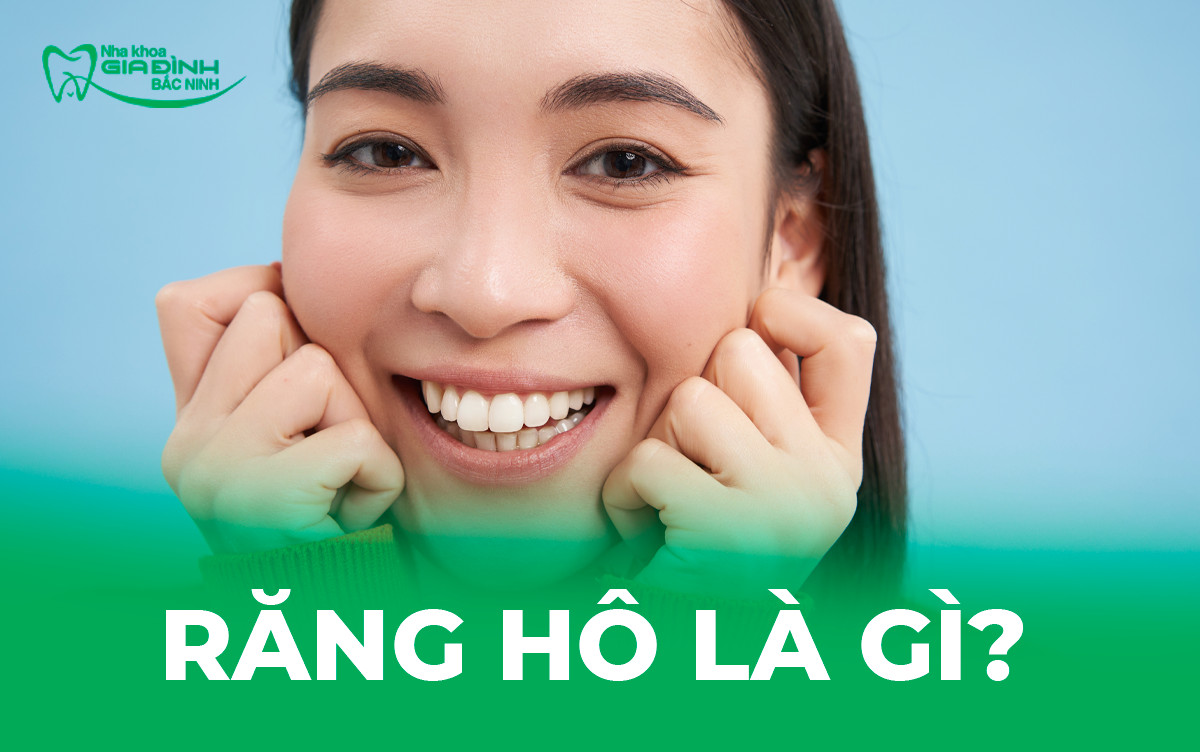 Răng Hô Có Bọc Sứ Được Không? 1 Răng Hô Có Bọc Sứ Được Không?