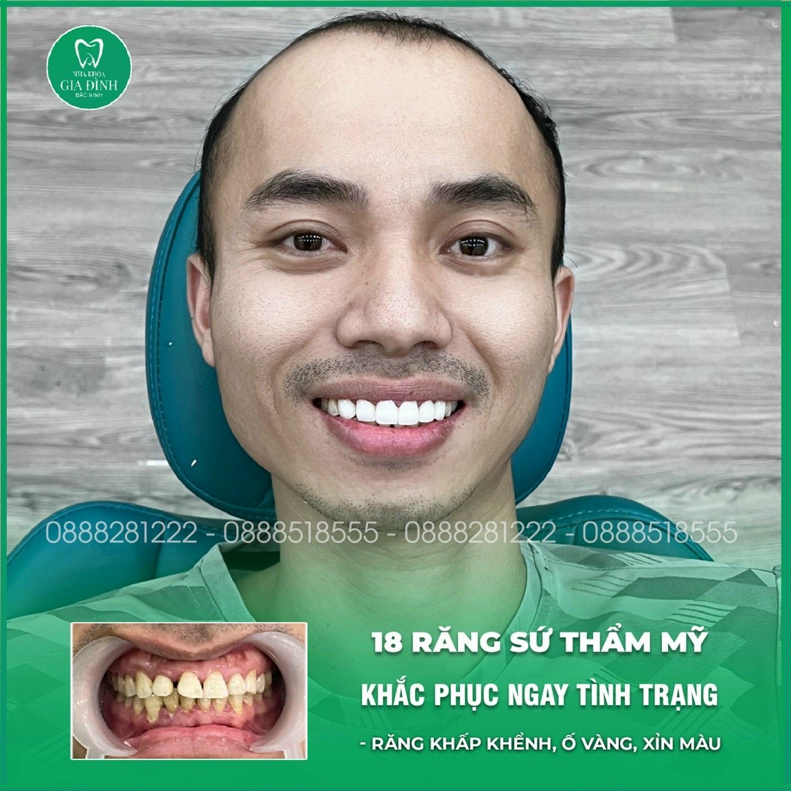 z5327794107787 75706f55c8385496722eb5668a38f7fb