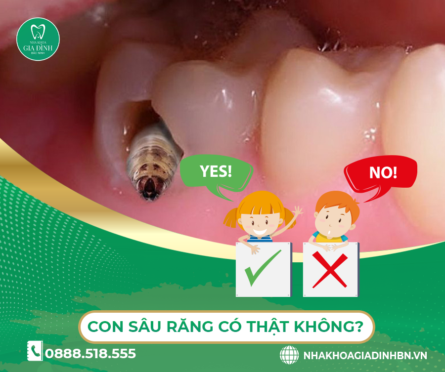 con sâu răng có thật không
