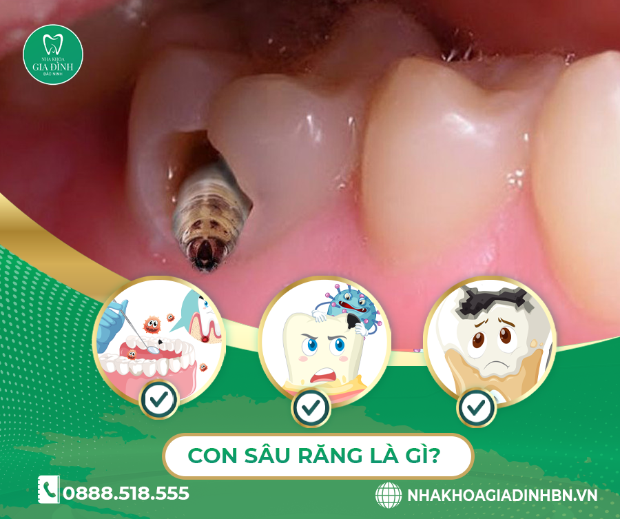 con sâu răng