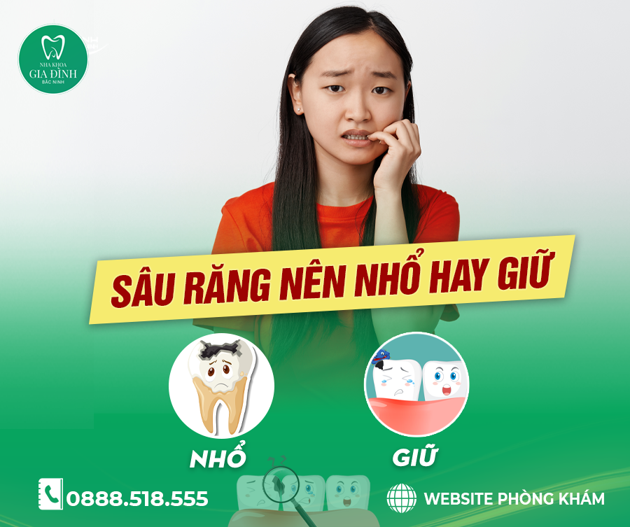 NÊN NHỔ RĂNG SÂU HAY GIỮ? QUY TRÌNH NHỔ RĂNG SÂU CHI TIẾT VÀ LƯU Ý QUAN TRỌNG