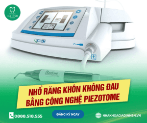 Địa chỉ nhổ răng khôn uy tín tại Bắc Ninh 4 Địa chỉ nhổ răng khôn uy tín tại Bắc Ninh