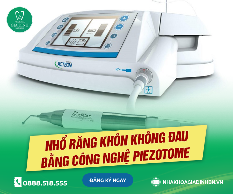 Nhổ-răng-bằng-công-nghệ-siêu-âm-Piezotome