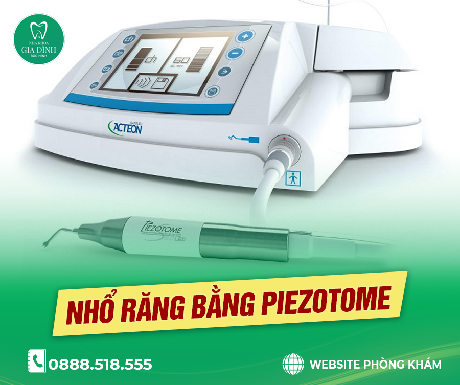 NÊN NHỔ RĂNG SÂU HAY GIỮ? QUY TRÌNH NHỔ RĂNG SÂU CHI TIẾT VÀ LƯU Ý QUAN TRỌNG