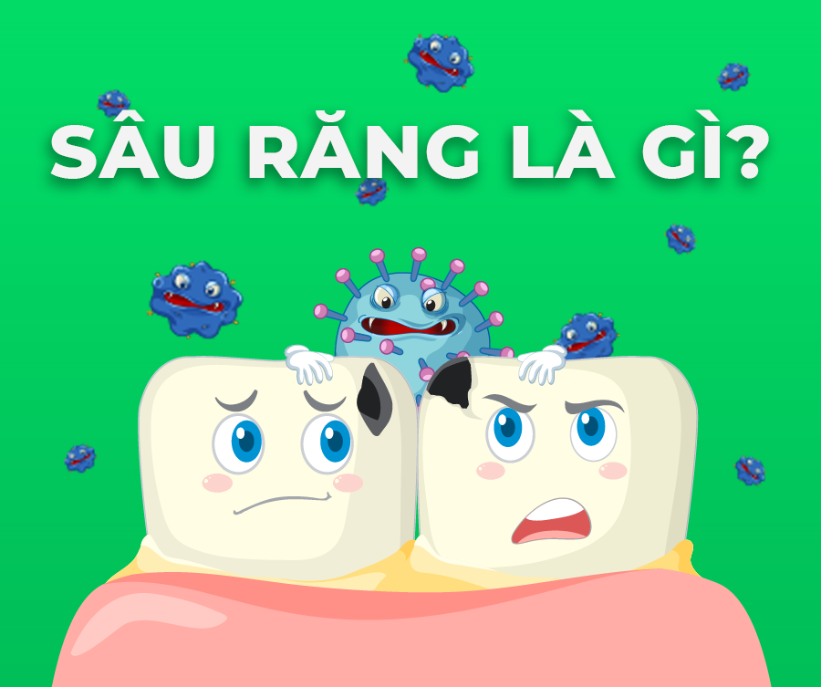 SÂU RĂNG : NGUYÊN NHÂN, DẤU HIỆU, ĐIỀU TRỊ VÀ CÁCH PHÒNG NGỪA HIỆU QUẢ