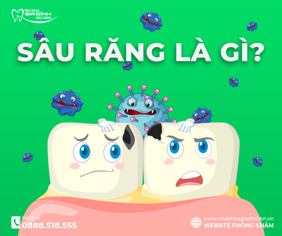 SÂU RĂNG : NGUYÊN NHÂN, DẤU HIỆU, ĐIỀU TRỊ VÀ CÁCH PHÒNG NGỪA HIỆU QUẢ