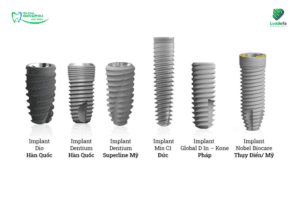 Trồng răng Implant có đau không? Sự thật & Giải pháp giảm đau hiệu quả