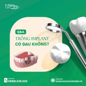 Trồng răng Implant có đau không? Sự thật & cách giảm đau khi trồng implant