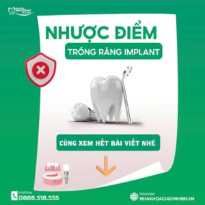 Top 9 Ưu Nhược Điểm Của Trồng Răng Implant