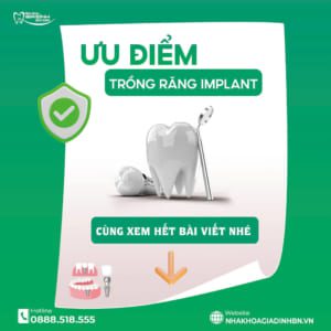 Top 9 Ưu Nhược Điểm Của Trồng Răng Implant