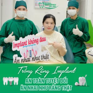 Trồng Răng Implant Mất Bao Lâu - Nha Khoa Gia Đình Bắc Ninh