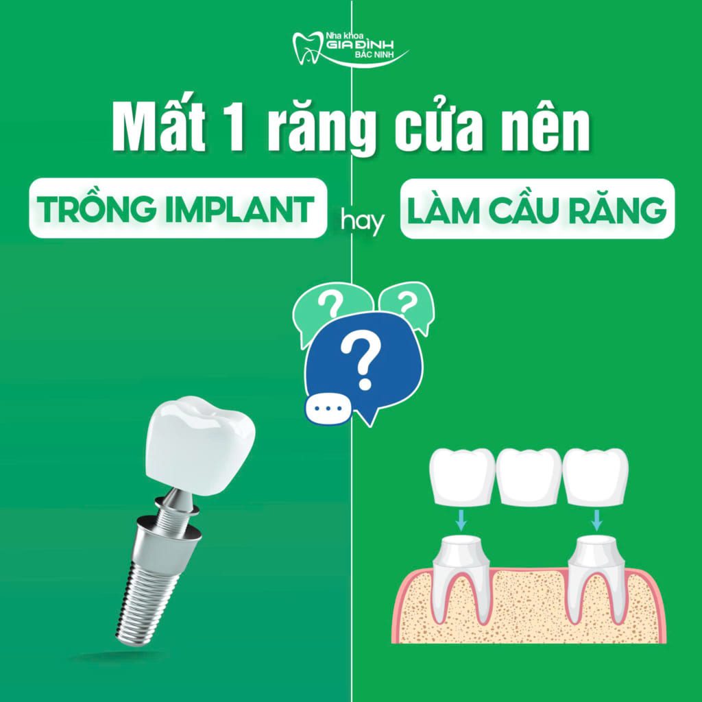 mat mot rang cua nen trong implant hay lam cau rang su