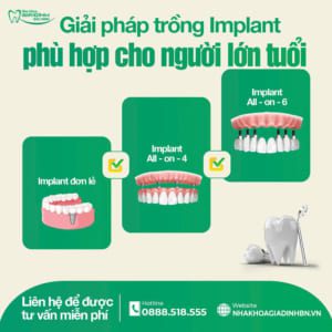 Người lớn tuổi có trồng Implant được không?