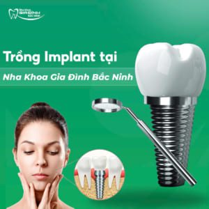 Trồng Implant cho người cao tuổi tại Bắc Ninh