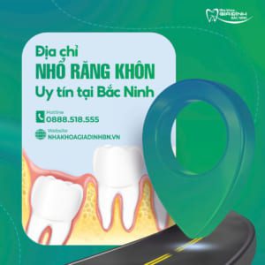 Địa chỉ nhổ răng khôn uy tín tại Bắc Ninh 1 Địa chỉ nhổ răng khôn uy tín tại Bắc Ninh