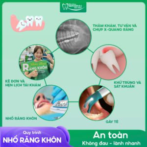 quy trinh nho rang khon