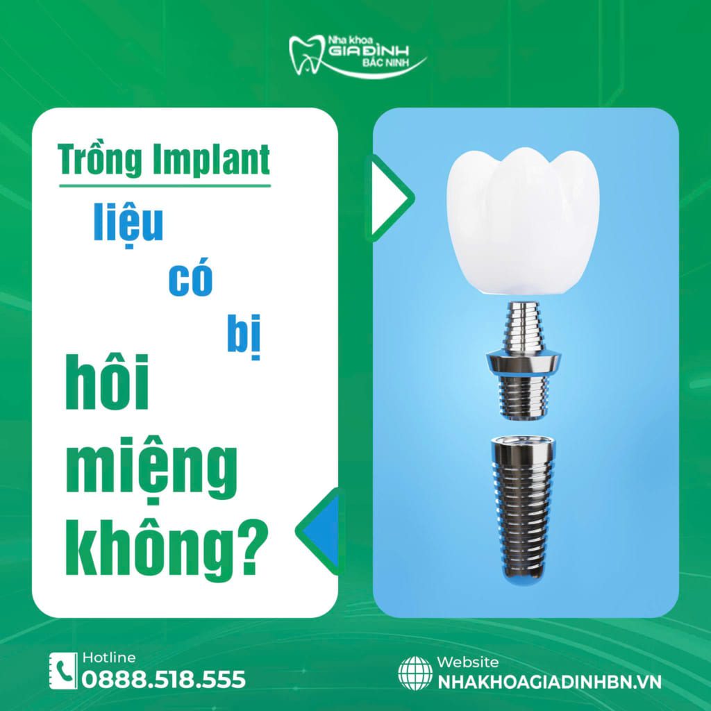 trong implant co bi hoi mieng khong