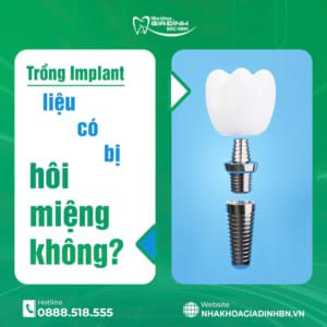 trong implant co bi hoi mieng khong