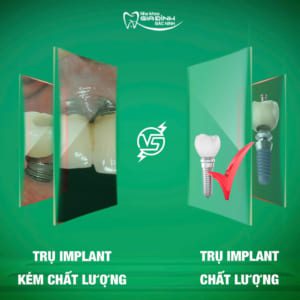Trồng răng implant có bị hôi miệng không?