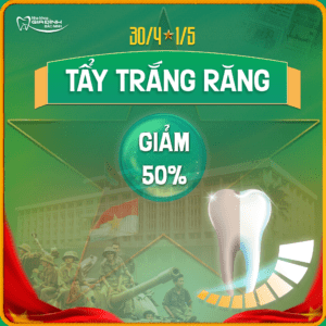 30.04 Tay trang