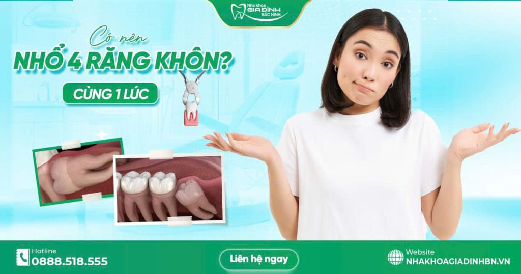 co nen nho 4 rang khon cung luc khong