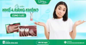 co nen nho 4 rang khon cung luc khong