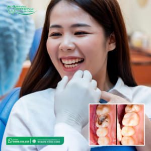 Hàn Răng Sâu Bao Nhiêu Tiền
