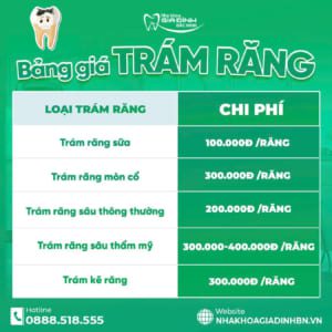 Hàn Răng Sâu Bao Nhiêu Tiền? Bảng Giá Hàn Răng Mới Nhất Tại Bắc Ninh
