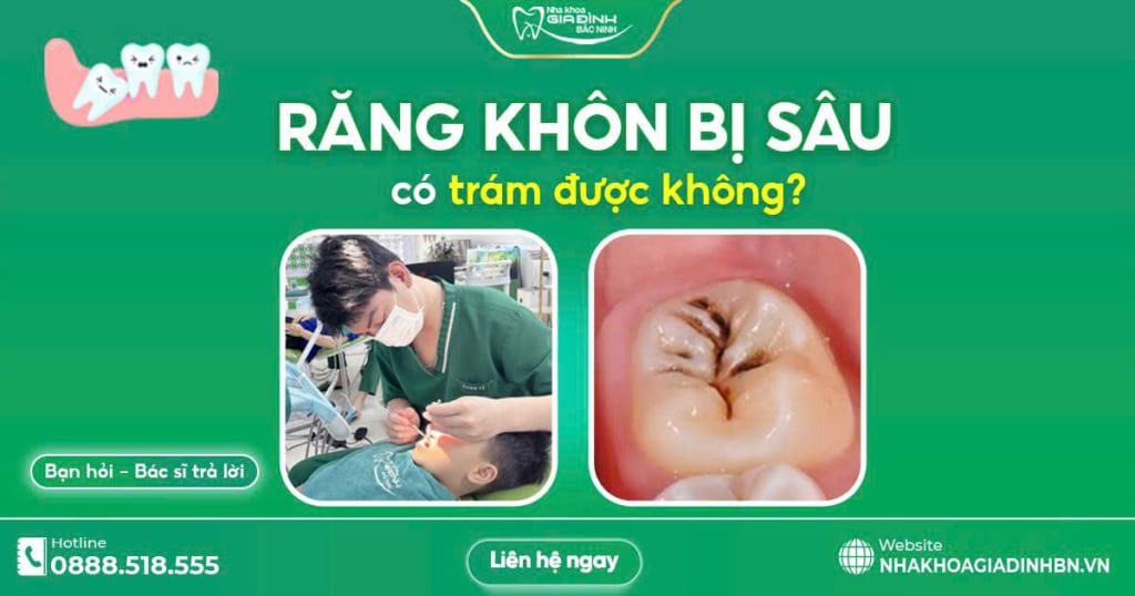 rang khon bi sau co tram duoc khong