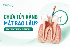 chua tuy rang mat bao lau