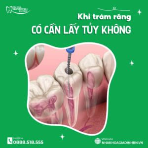 tram rang sau co lay tuy khong