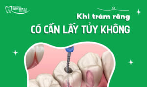 tram rang sau co lay tuy khong e1782546594590