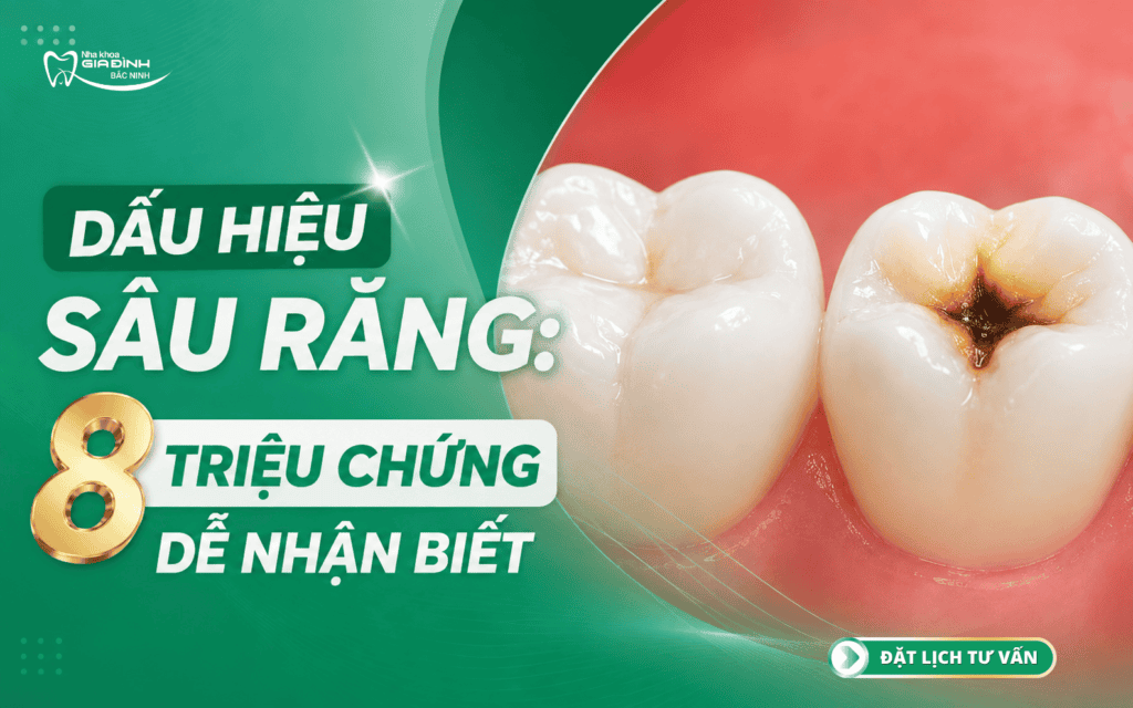 Dấu Hiệu Sâu Răng: 8 Triệu Chứng Dễ Nhận Biết 11 dau hieu sau rang